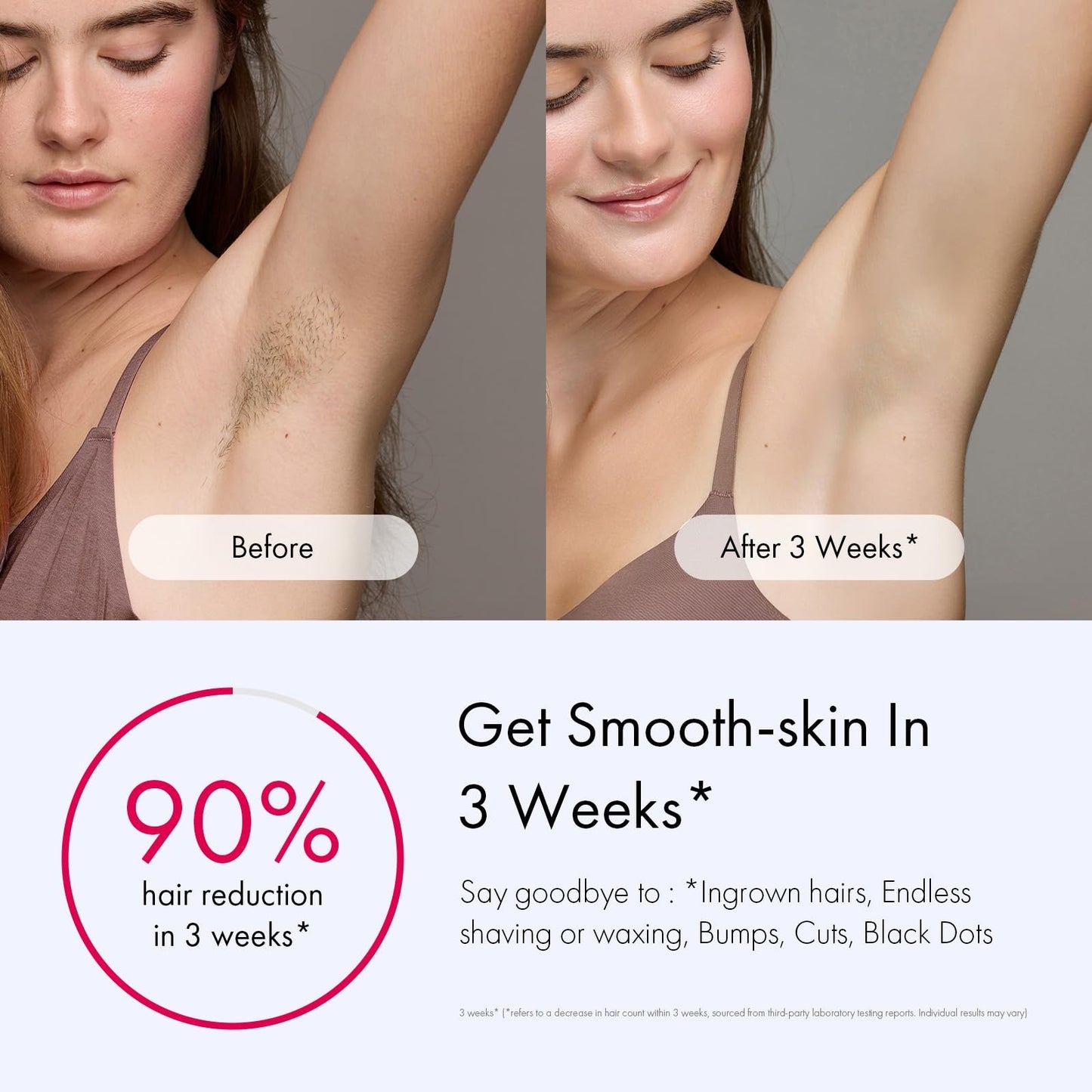 Air 10 IPL Hair Removal Device with Ice Cooling Technology – Permanent, Painless At-Home Treatments for Women and Men