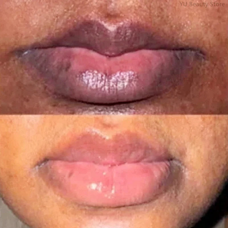 Dark Lip Repair Balm