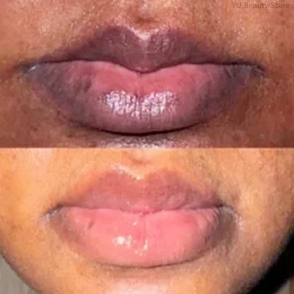 Dark Lip Repair Balm