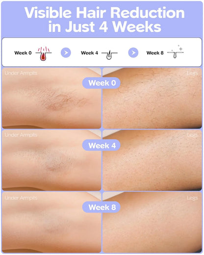 Fashiquee IPL Laser Hair Removal Device