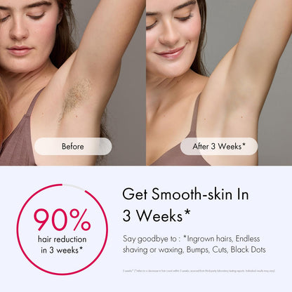 Air 10 IPL Hair Removal Device with Ice Cooling Technology – Permanent, Painless At-Home Treatments for Women and Men